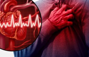 Masivni infarkt – Zašto je tako opasan i kako prepoznati simptome…